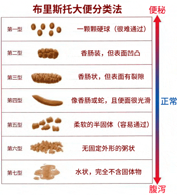 医生说排便时出现“4种形状、4种颜色”<strong></p>
<p>摘取okex技术指标</strong>，最好查一下肠镜，指的具体是什么？
